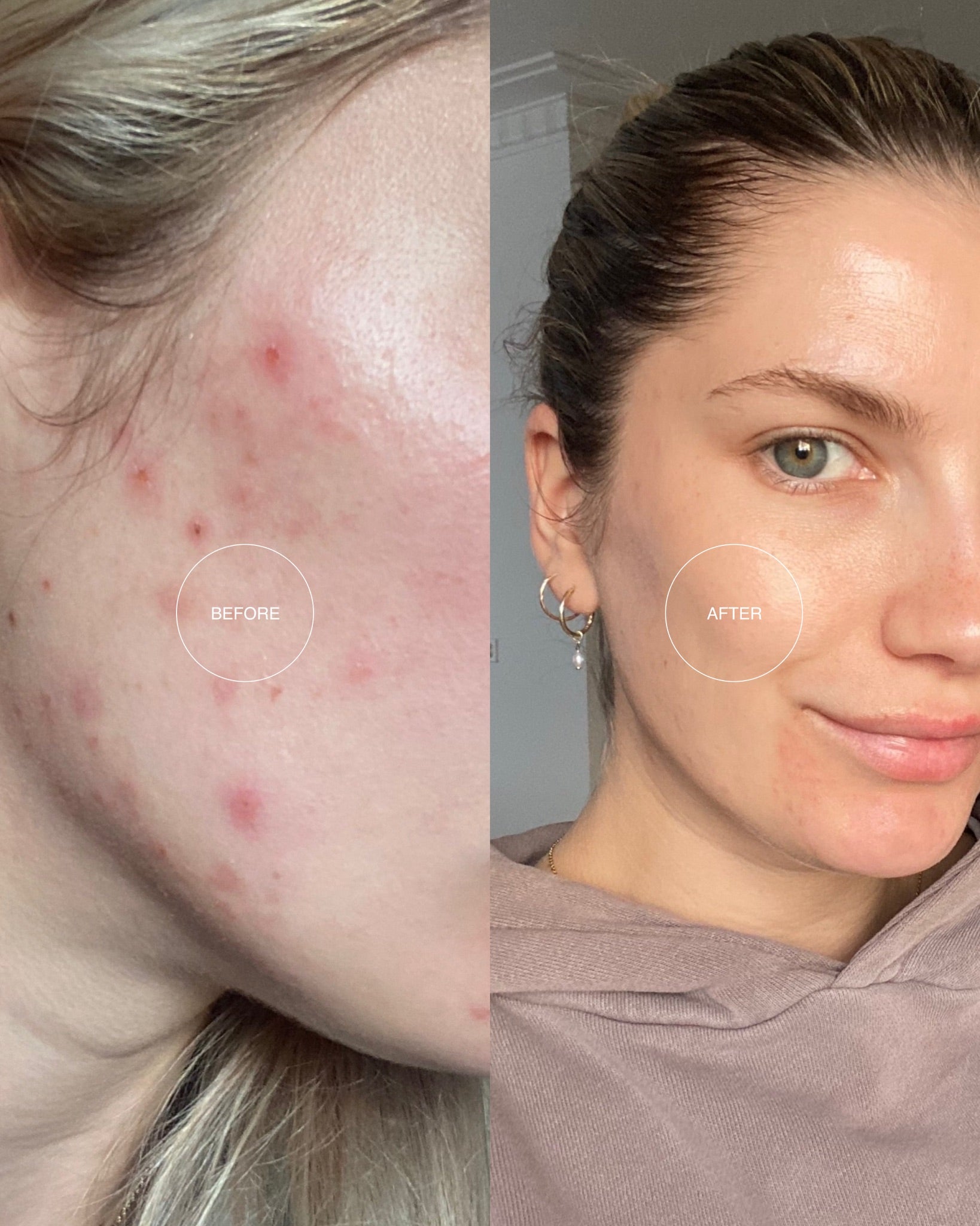 Deep Hydration Cream