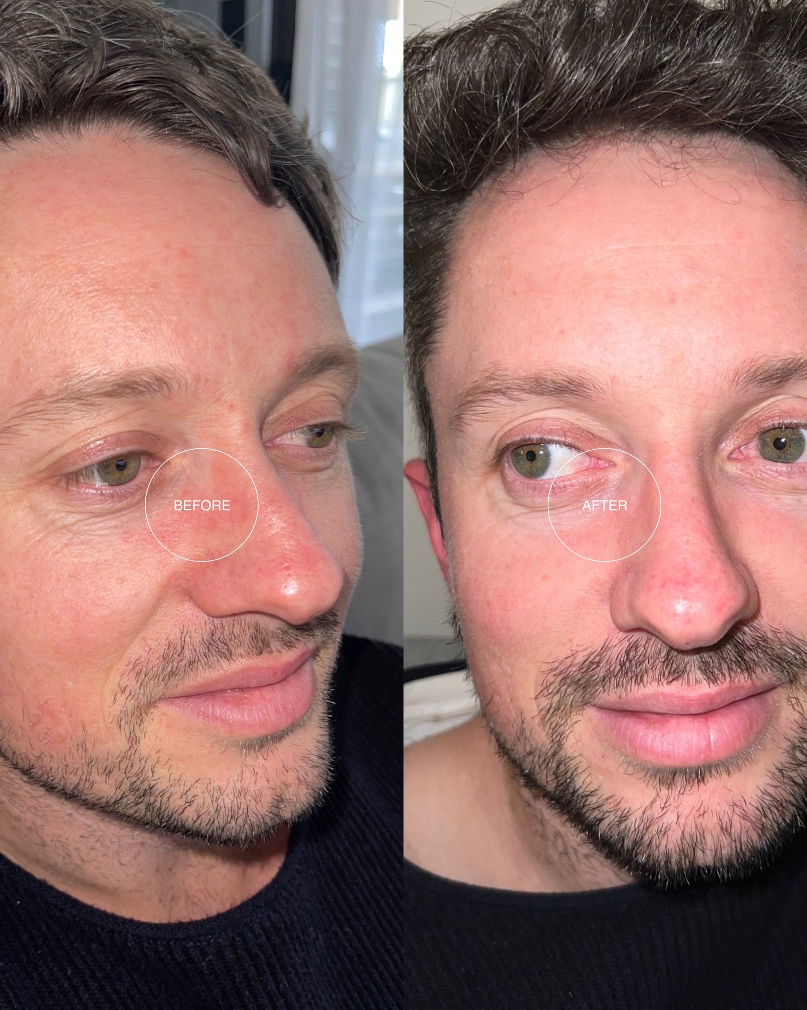 Deep Hydration Cream
