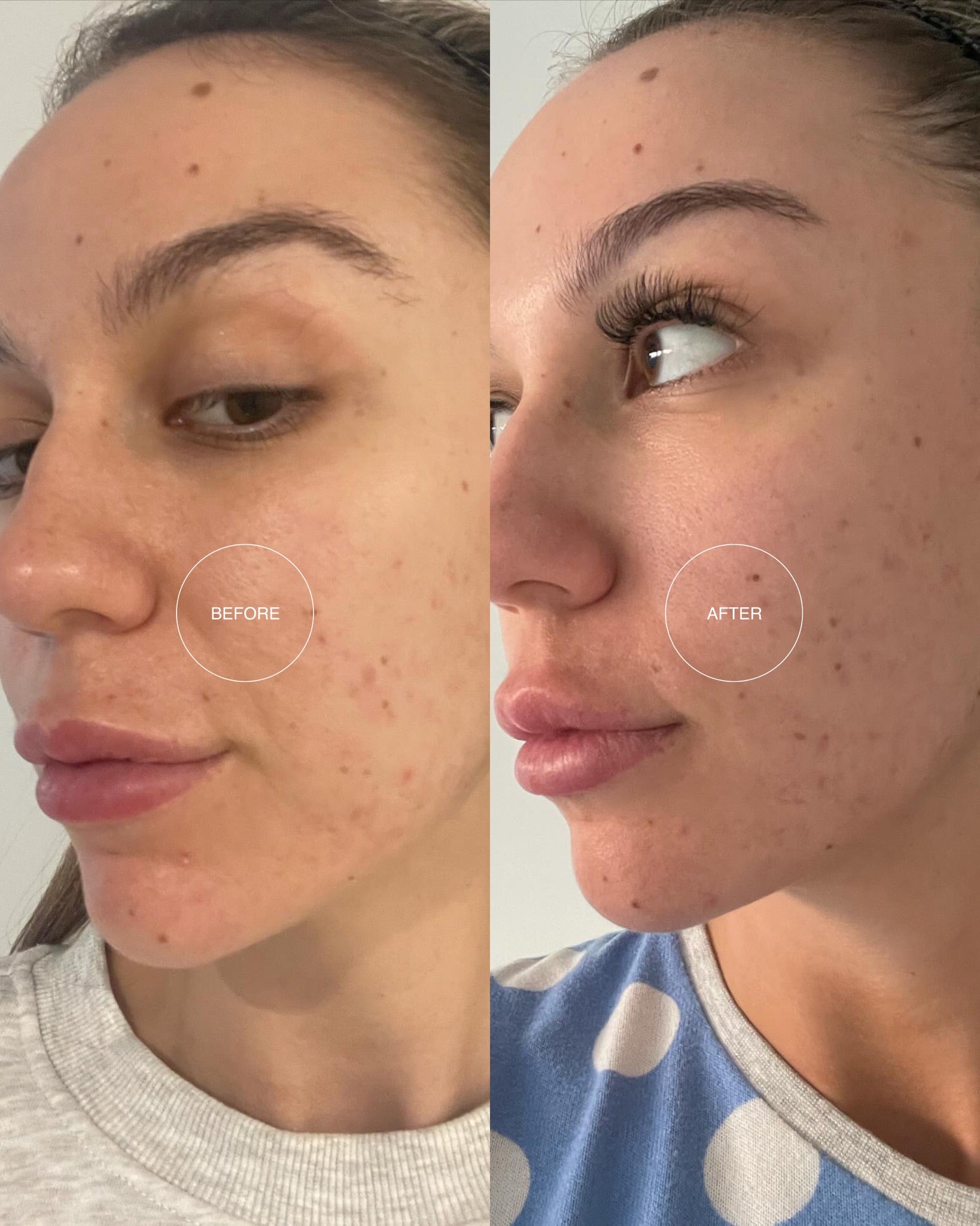 Essential Skincare Bundle